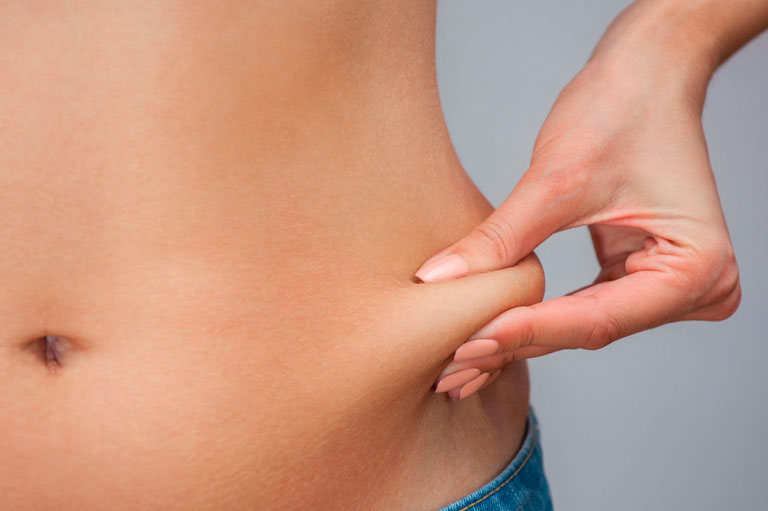 Problema: Adiposidad localizada